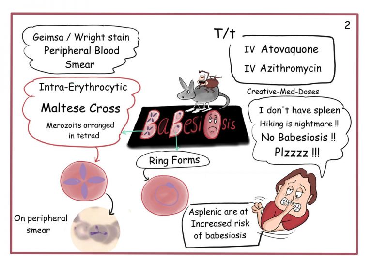 Babesiosis - Creative Med Doses