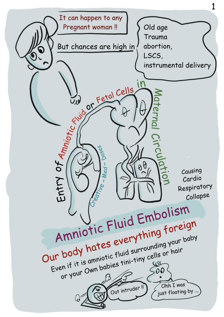 amniotic fluid embolism statistics