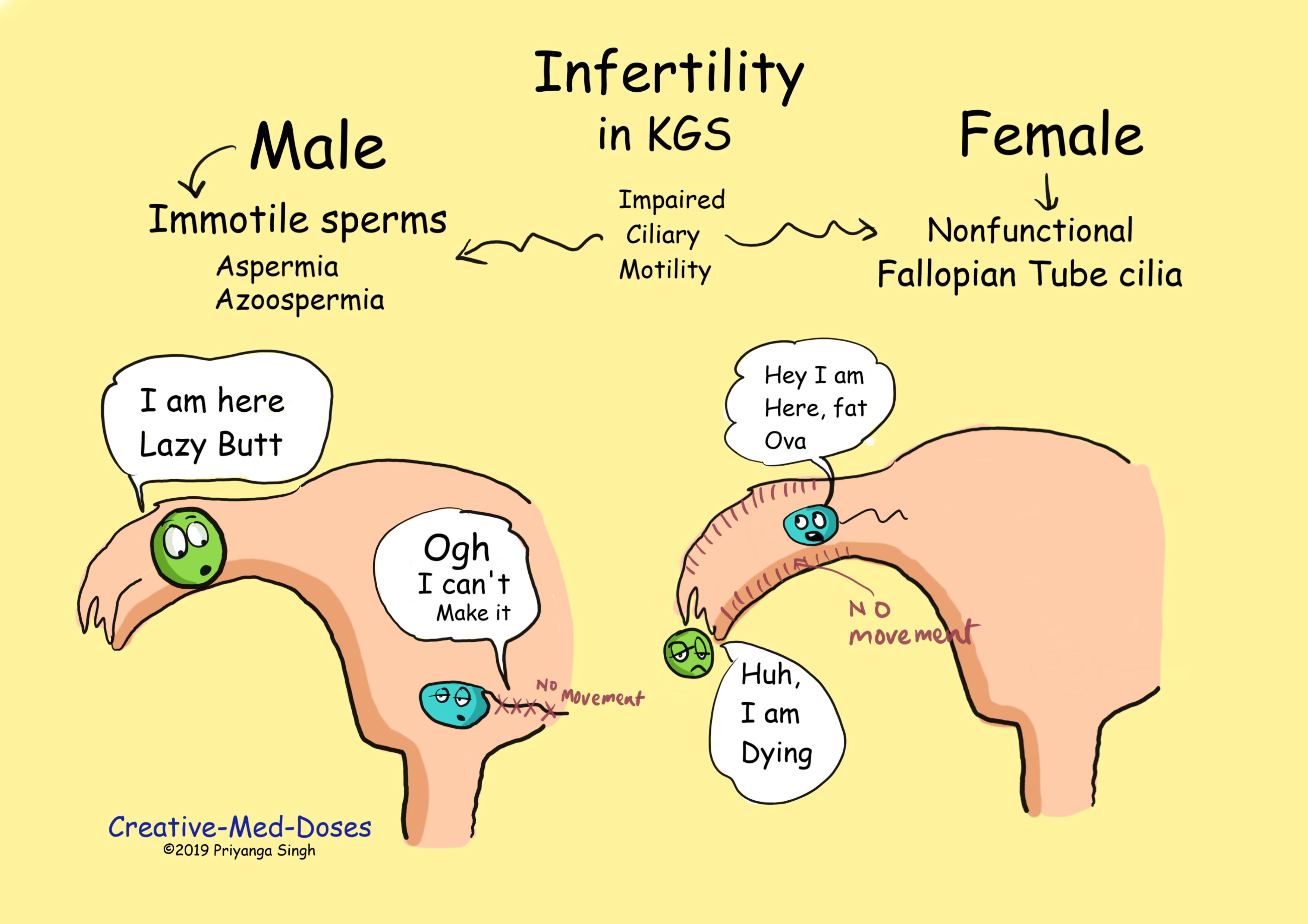 Pathogenesis of Male and female infertility in kartagener syndrome 