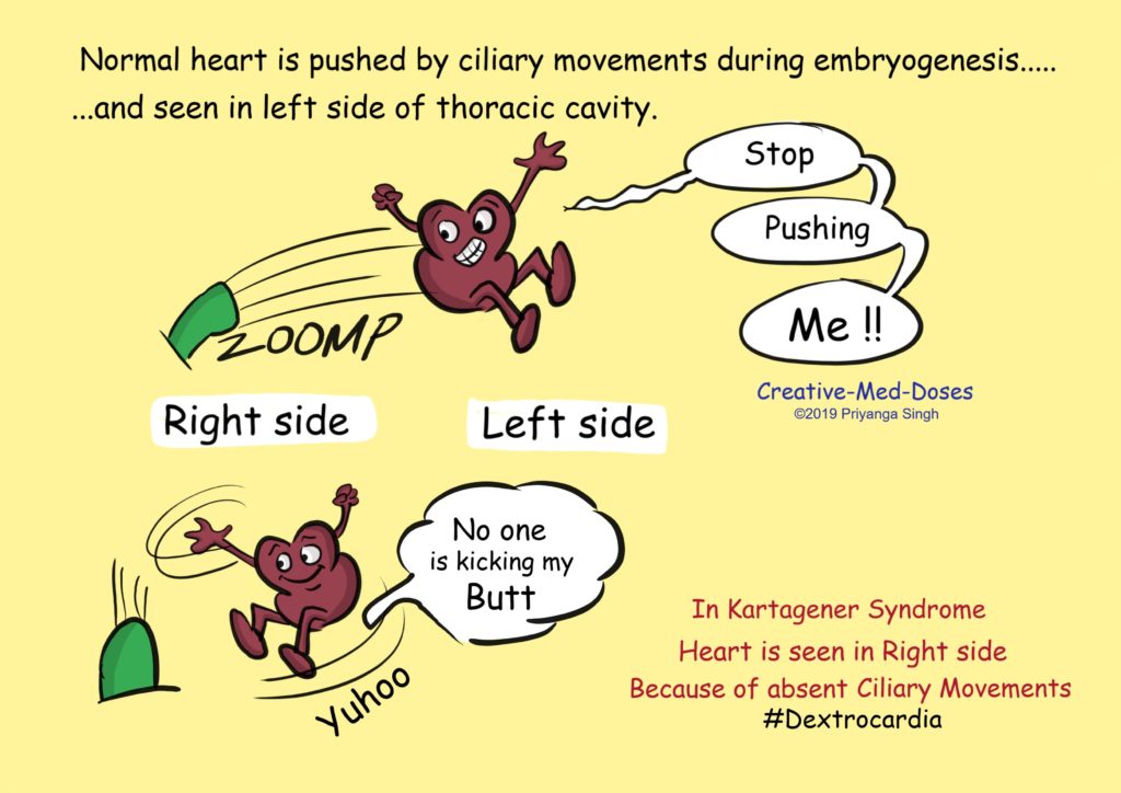 Kartagener syndrome where cilia doesn't move - Creative Med Doses