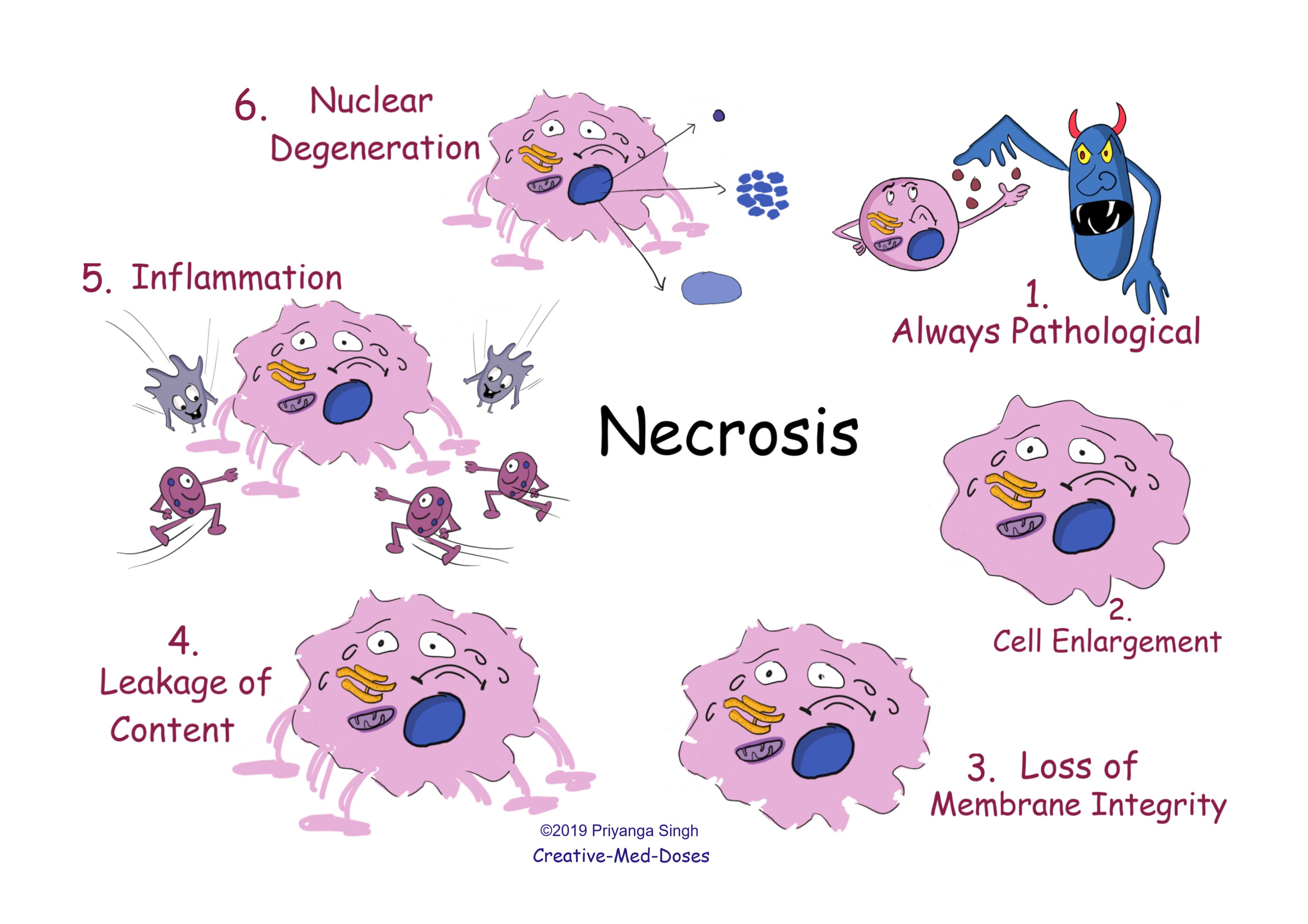 Necrosis main features
Necrosis VS apoptosis  