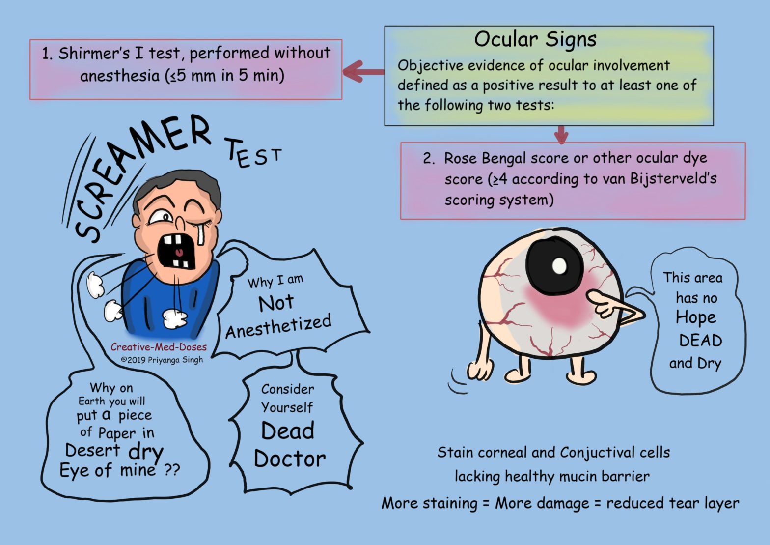 Sjogren syndrome: Ocular Signs