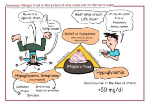 Insulinoma - Beta cell tumor - Creative Med Doses