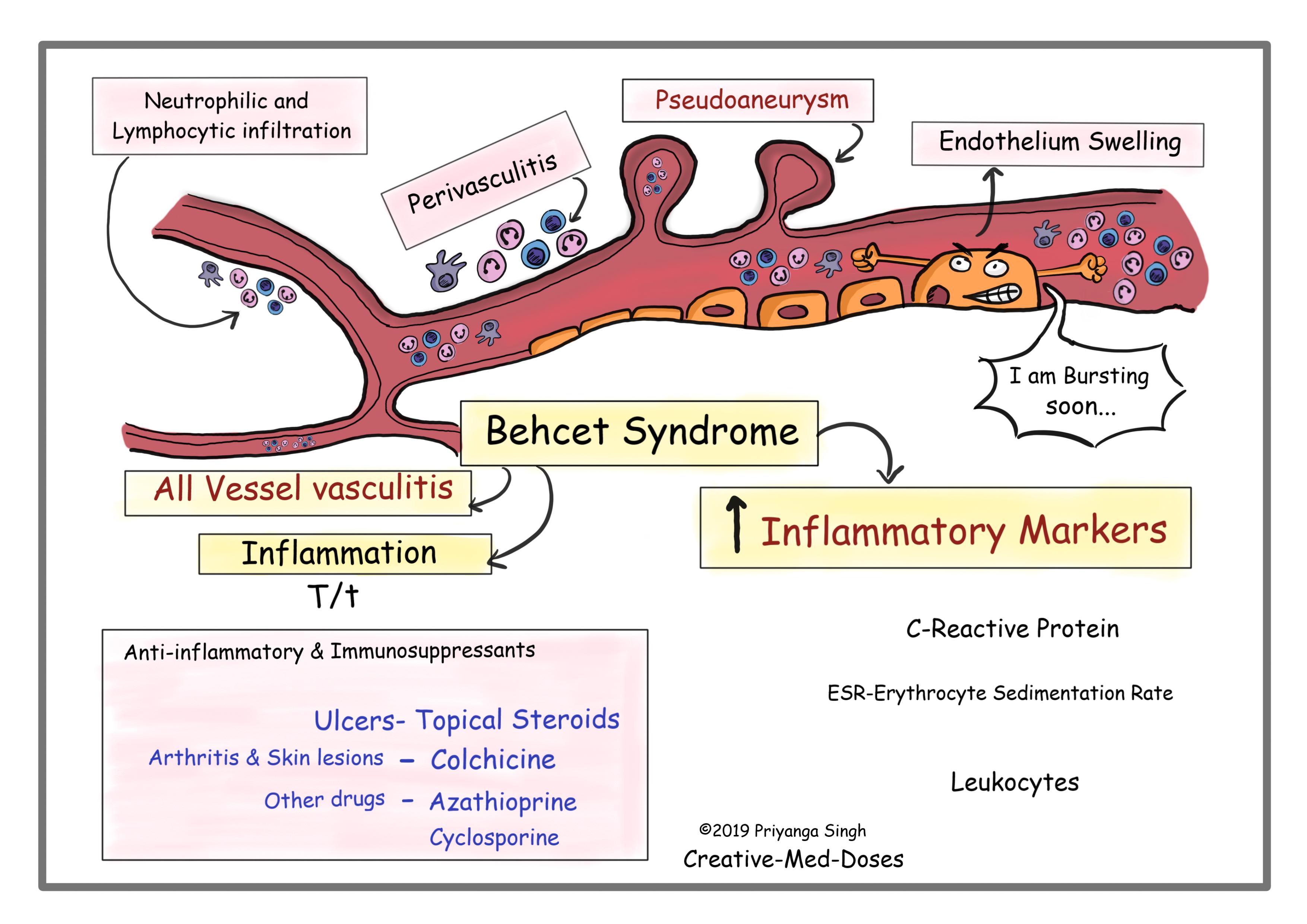 Behcet Syndrome is all vessel vasculitis, visual map for pathogenesis, treatment and laboratory markers