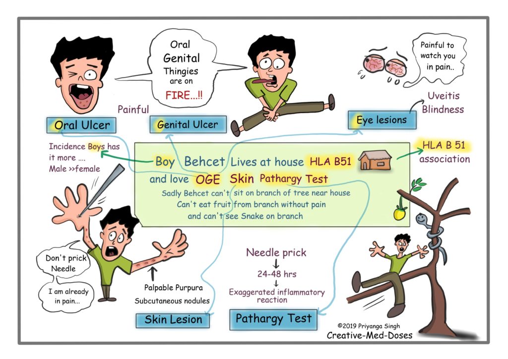 Behcet syndrome: Ulcers, Blindness and Vasculitis ...