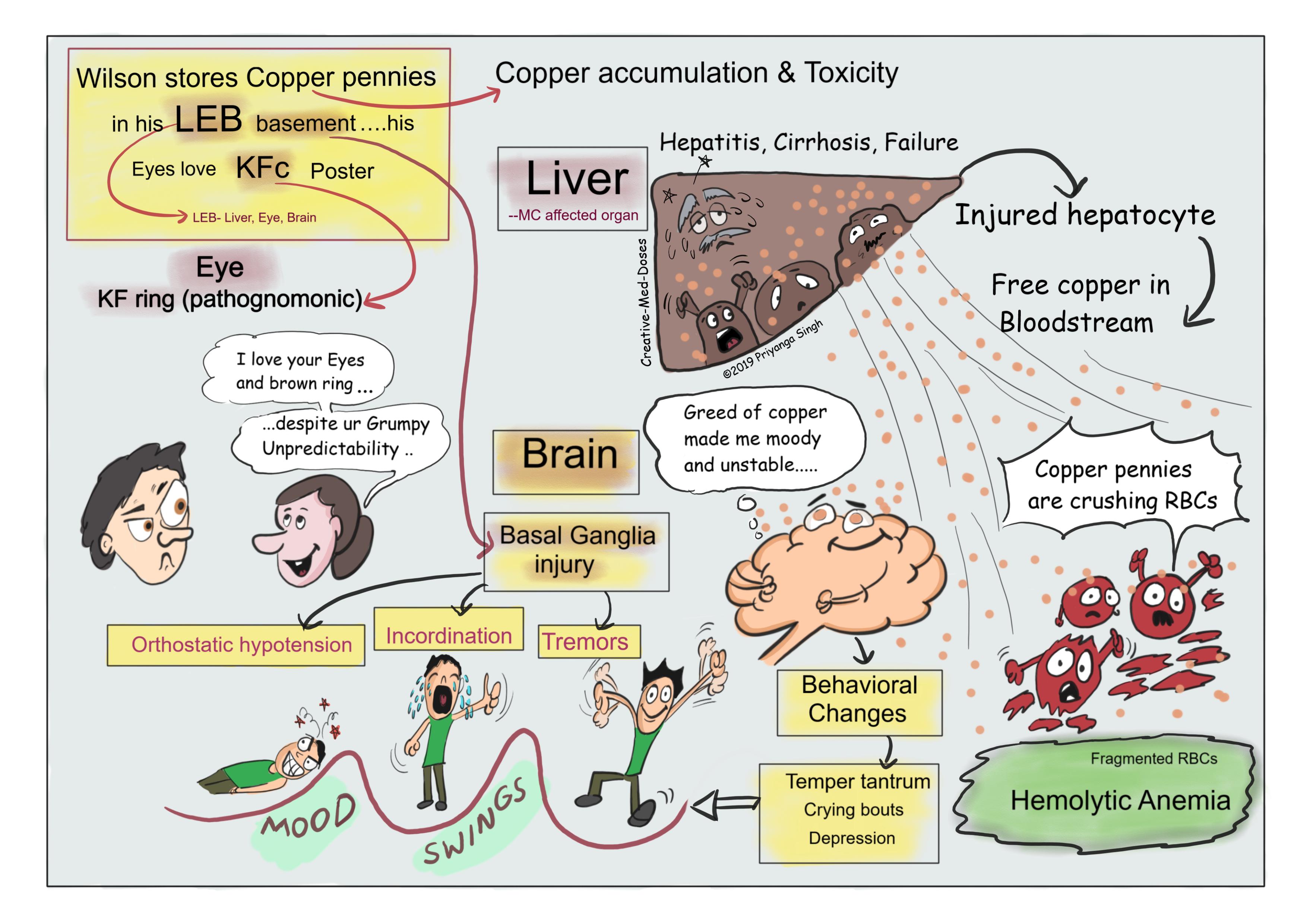 Wilson disease: Copper everywhere - Creative Med Doses