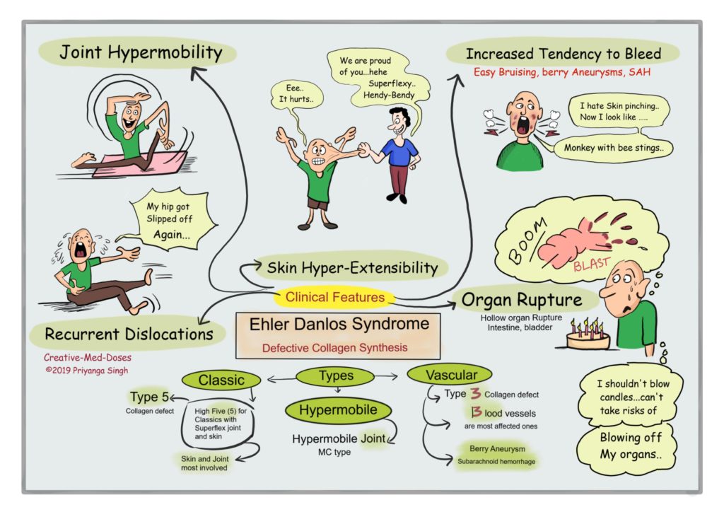 Ehlers Danlos Syndrome Eds Creative Med Doses 3622