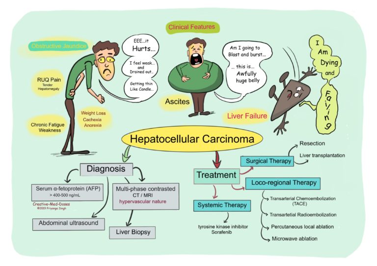 Hepatocellular Carcinoma (HCC) - Creative Med Doses