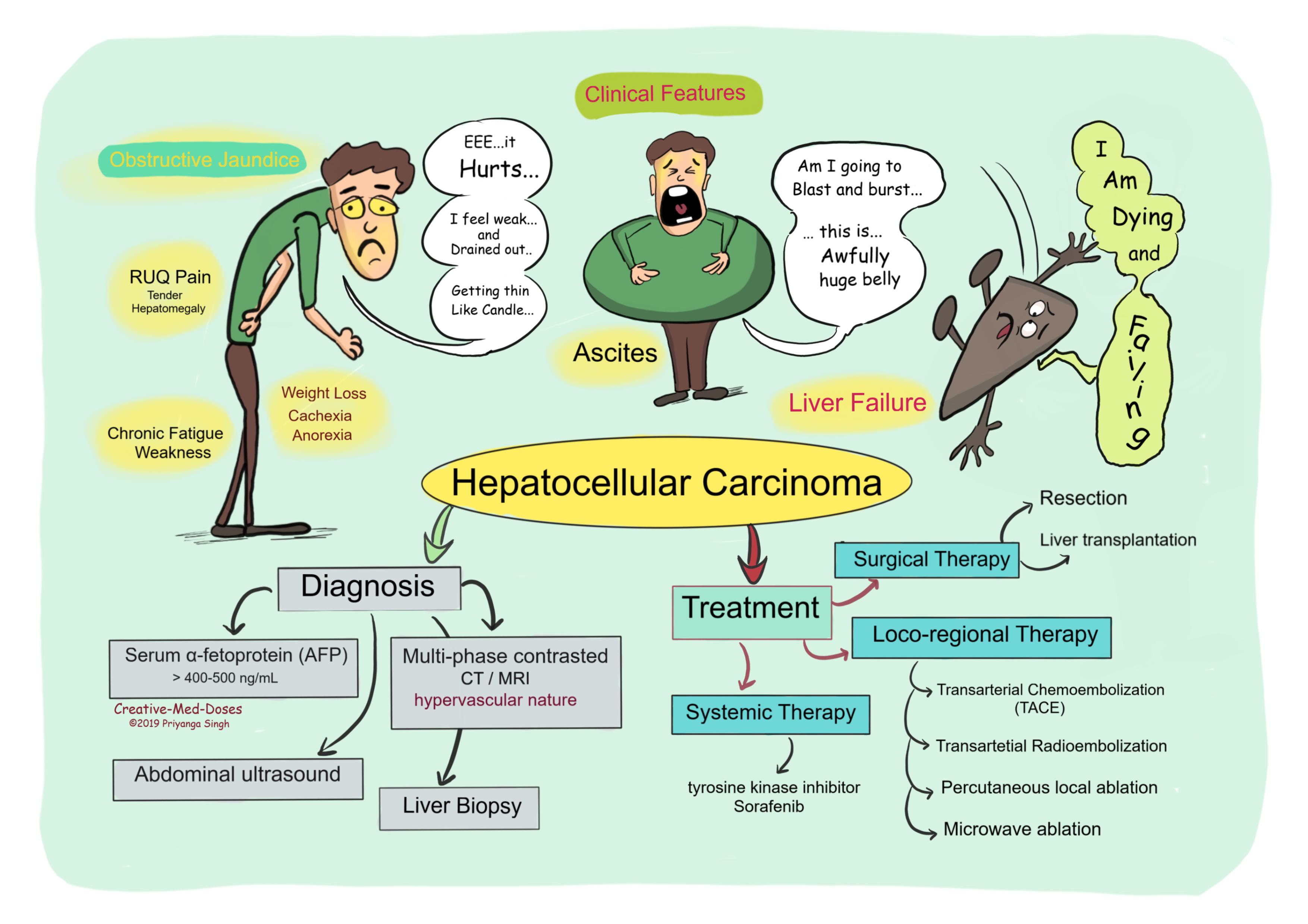 Hepatocellular Carcinoma Clinical Presentation, Diagnosis and Treatment 