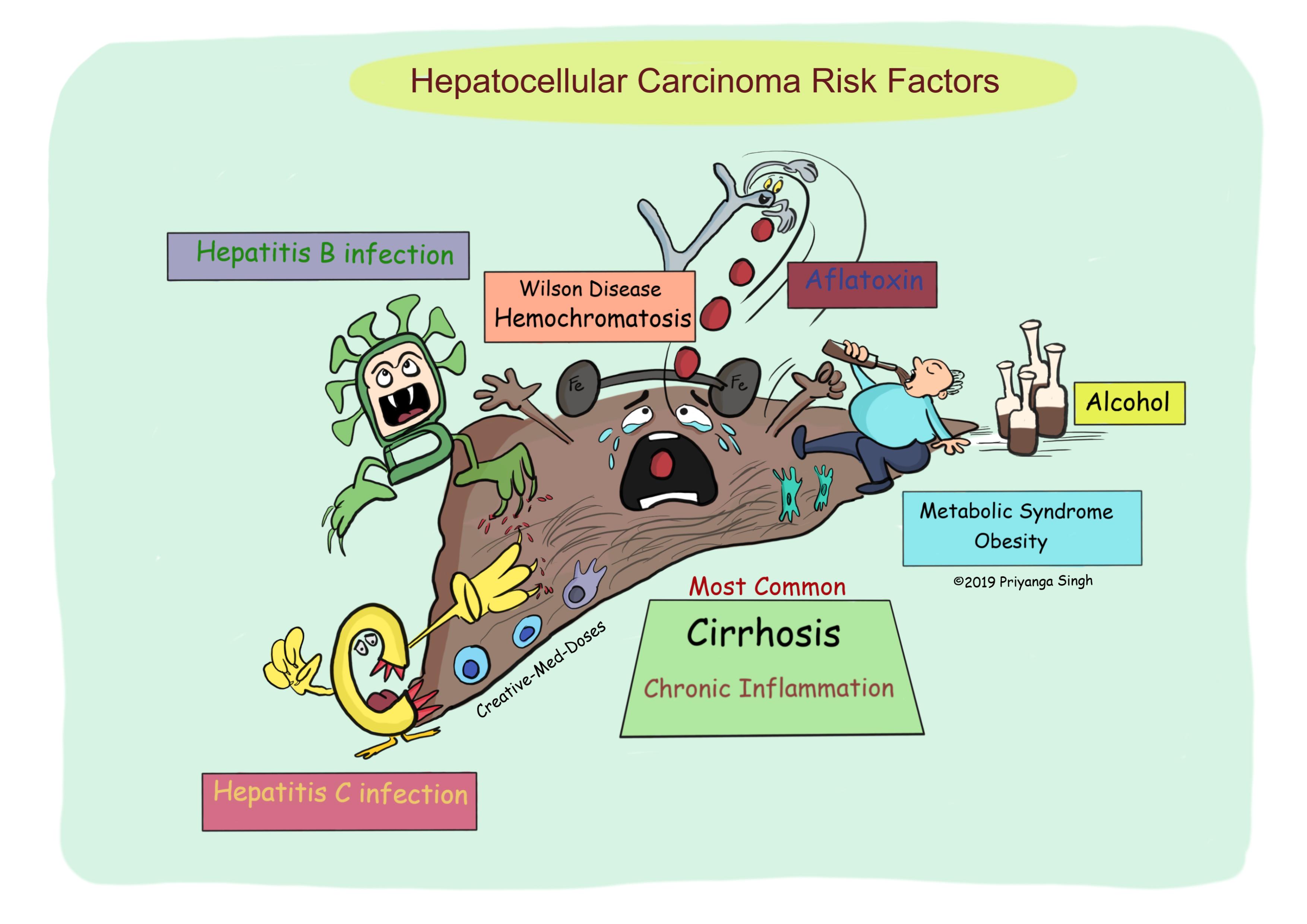Hepatocellular Carcinoma (HCC) - Creative Med Doses