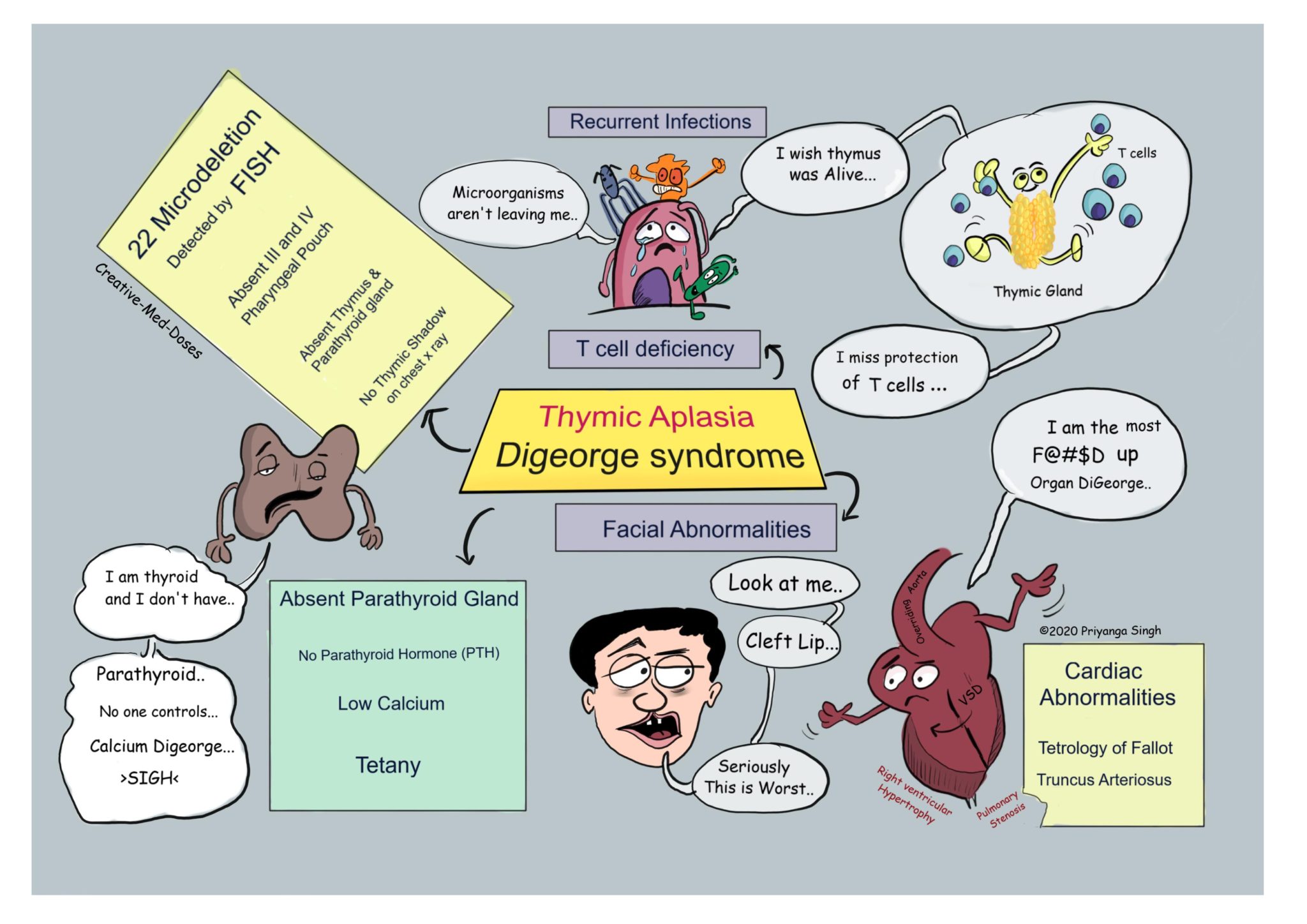 Digeorge Syndrome Facial Features.