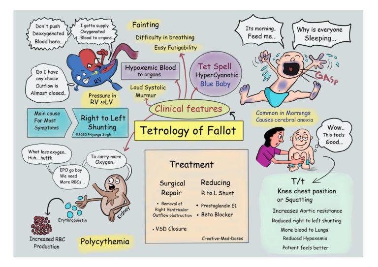 Tetralogy of Fallot: Fatal Four - Creative Med Doses