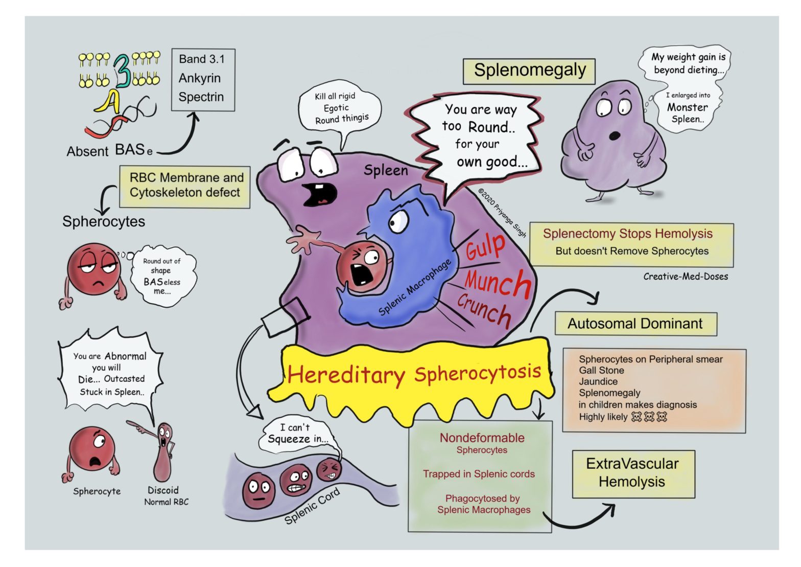 Hereditary Spherocytosis