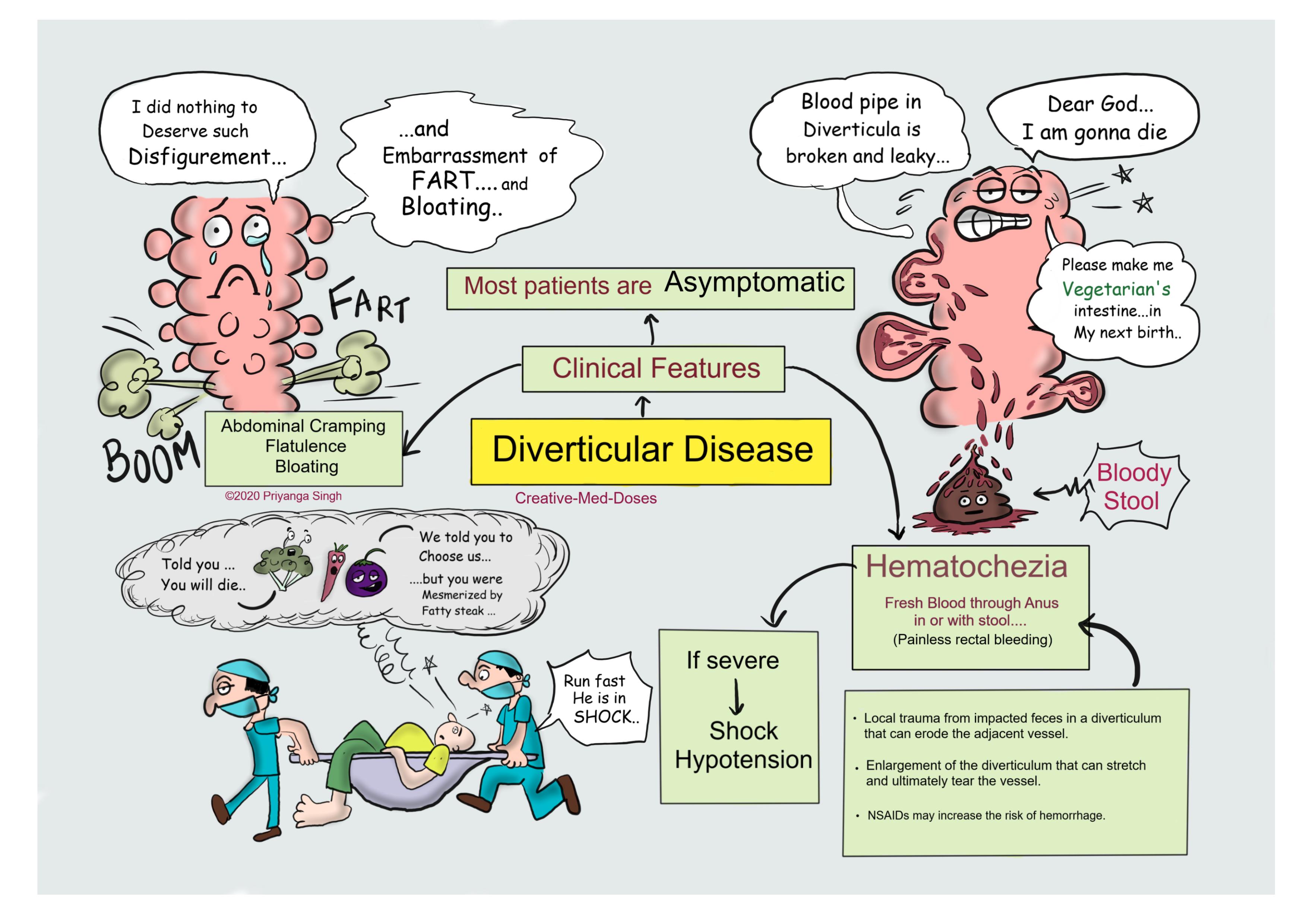 Diverticular disease of intestine: Clinical features 