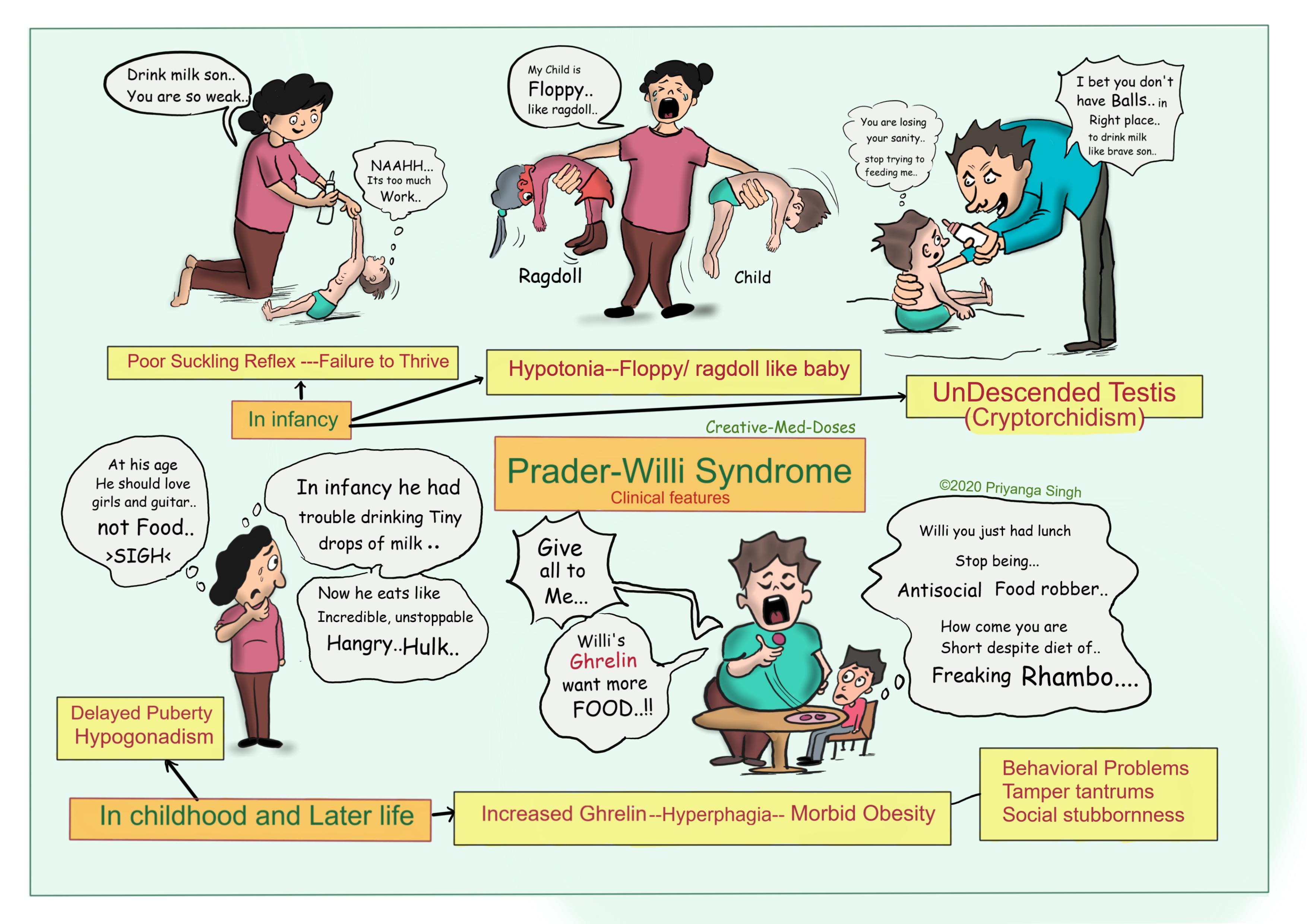 Prader-Willi syndrome: Clinical features 