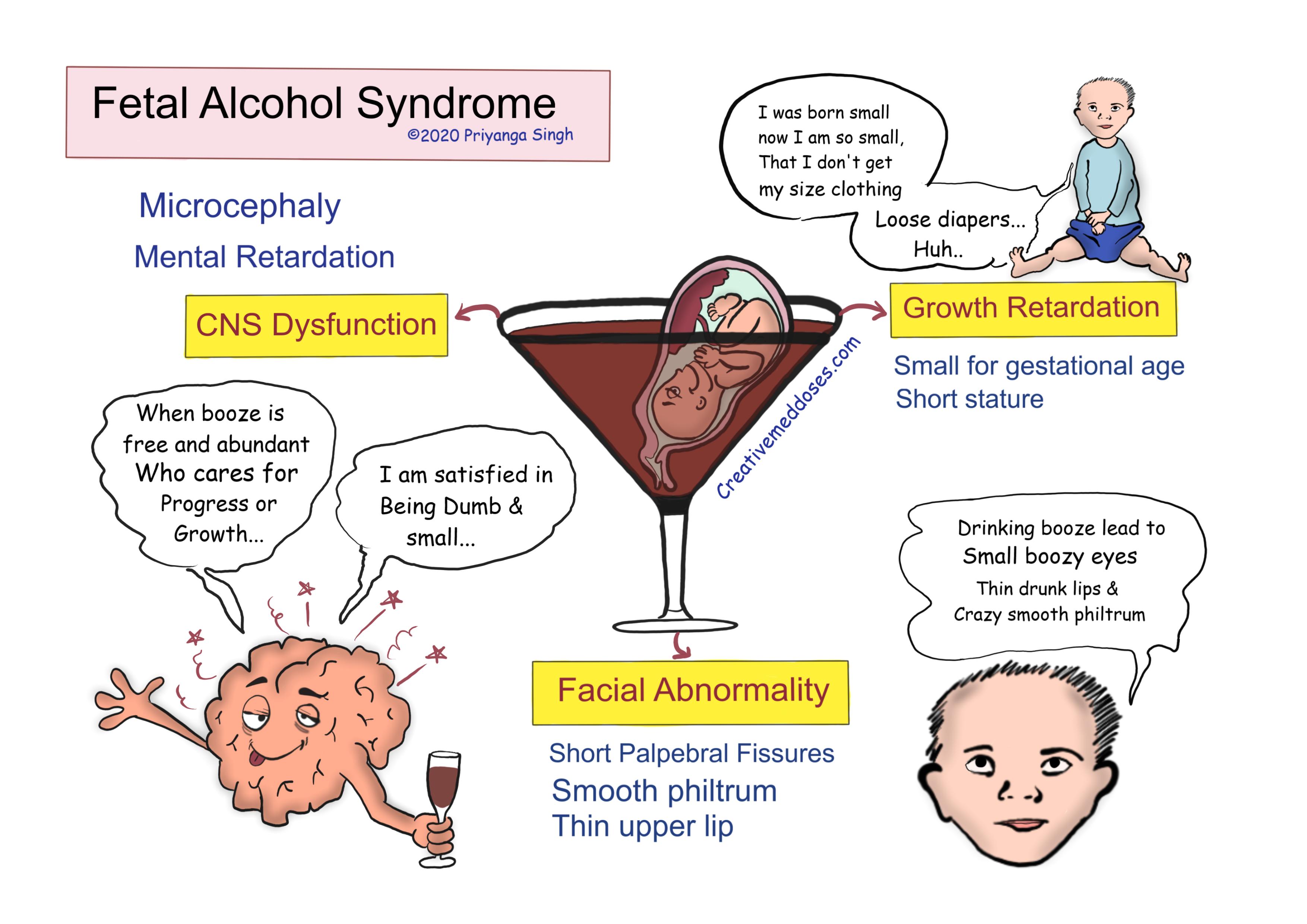 Fetal Alcohol Syndrome Infographics