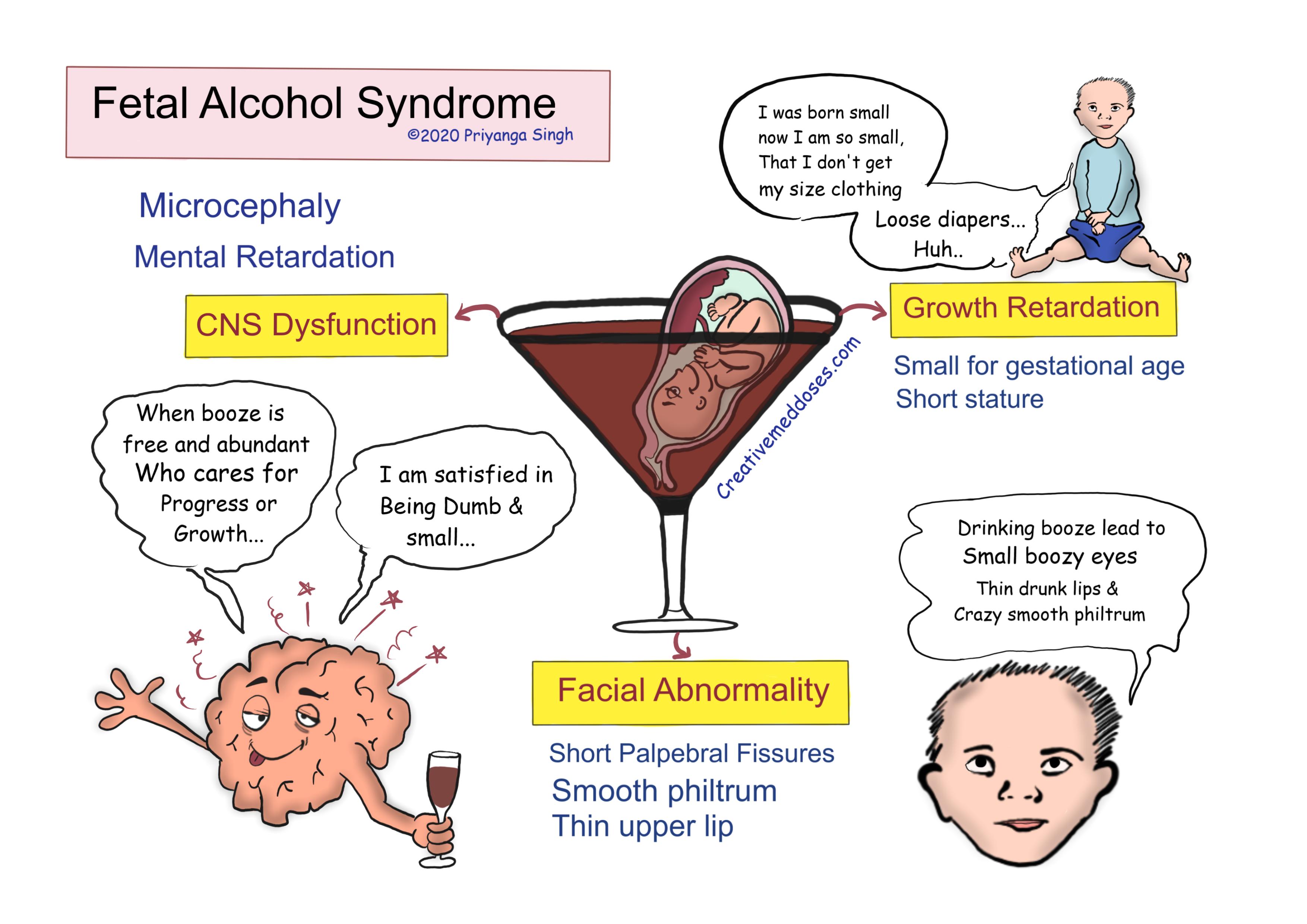 Fetal Alcohol Syndrome FAS Creative Med Doses