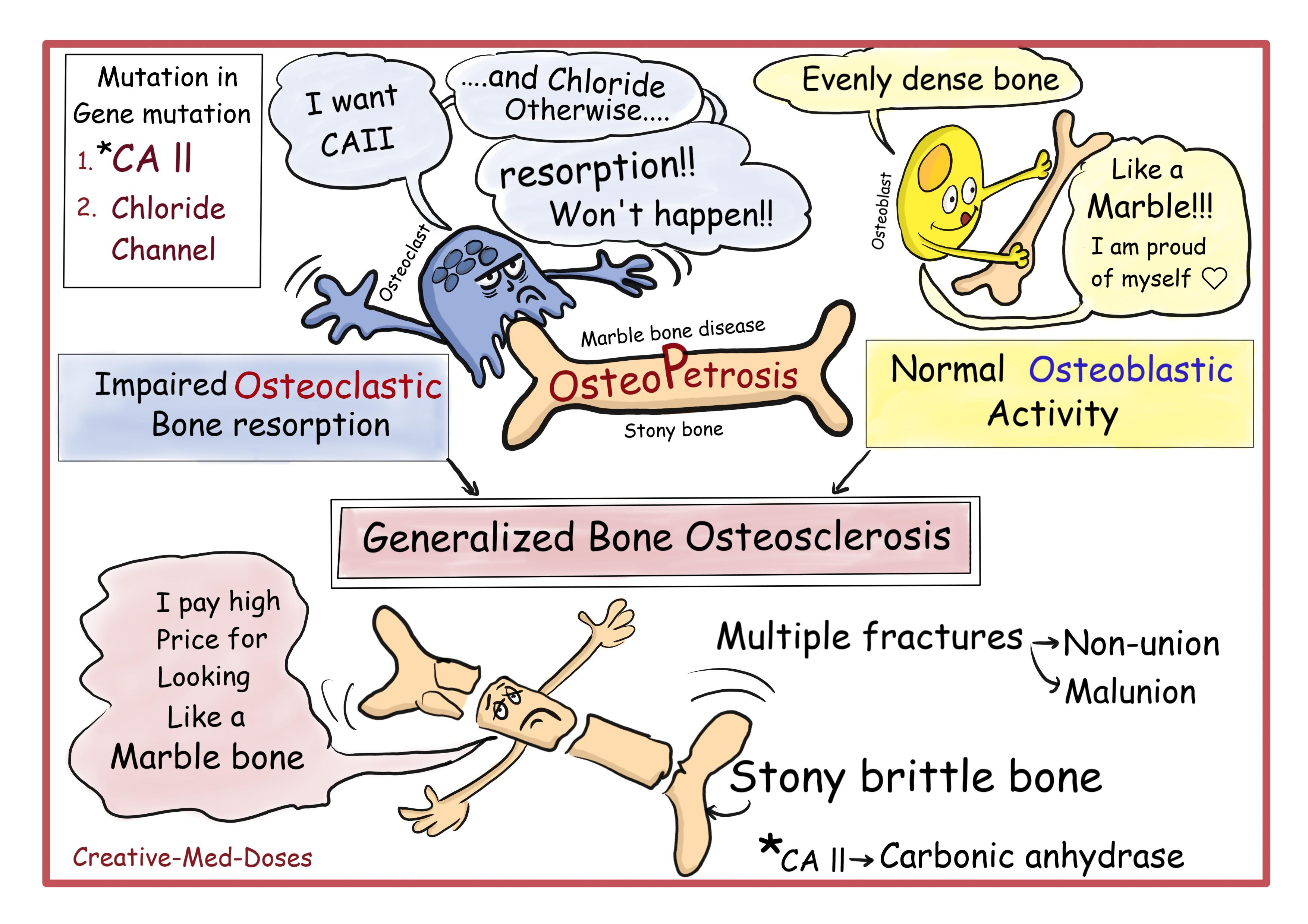 Osteopetrosis cartoons and illustrations