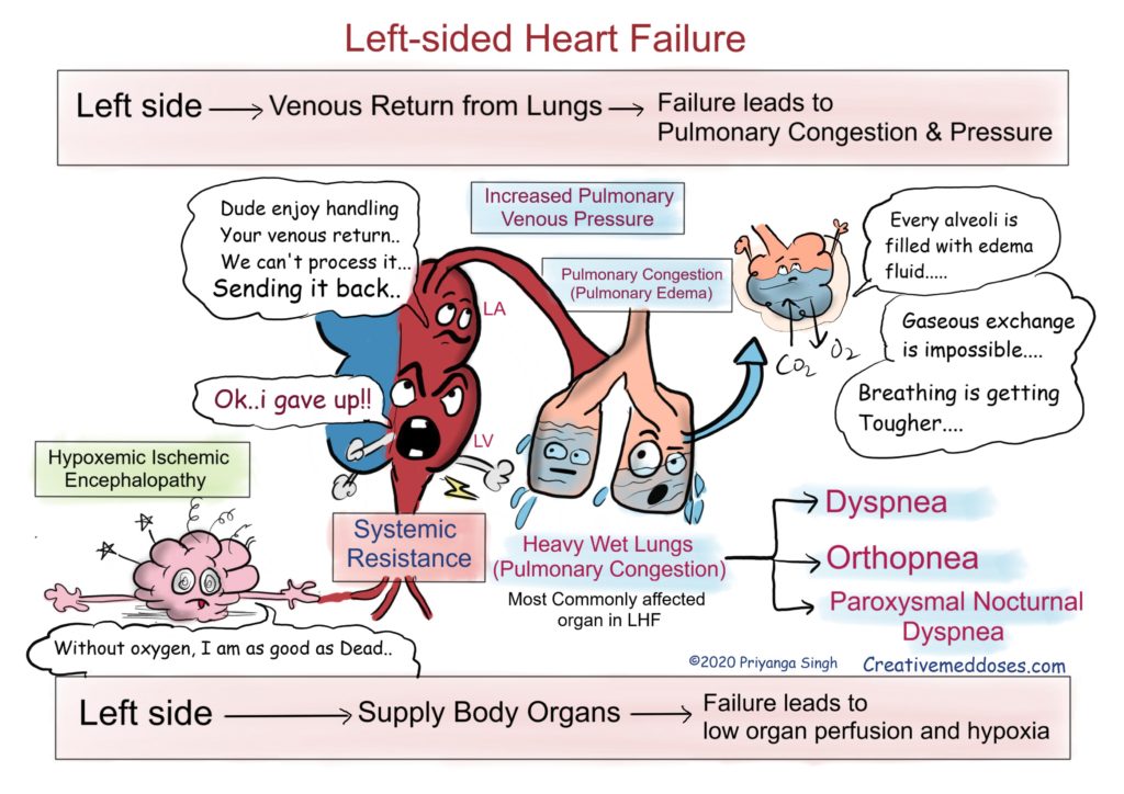 Heart Failure Left Sided Vs Right Sided Creative Med Doses