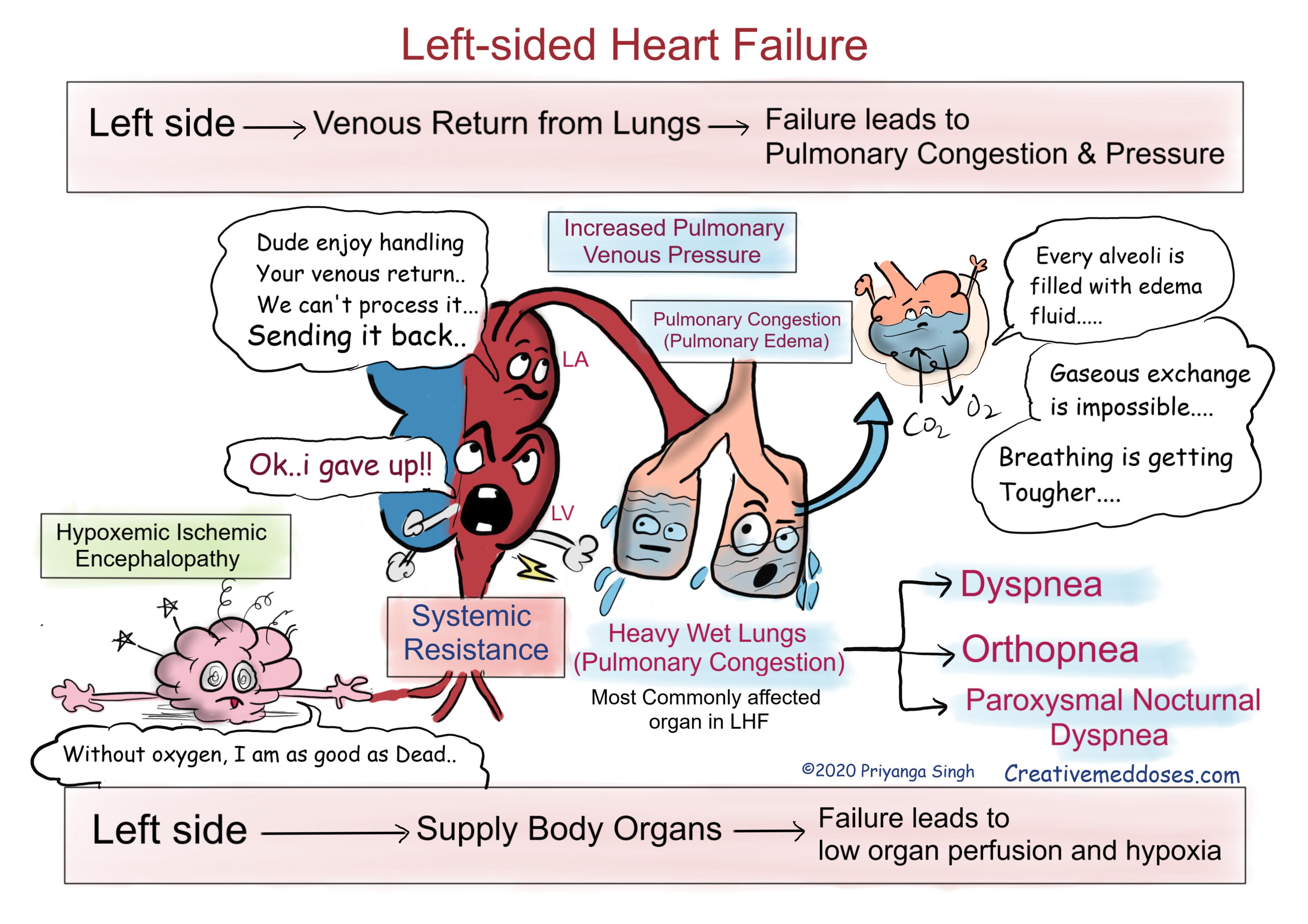 left sided heart failure infographics