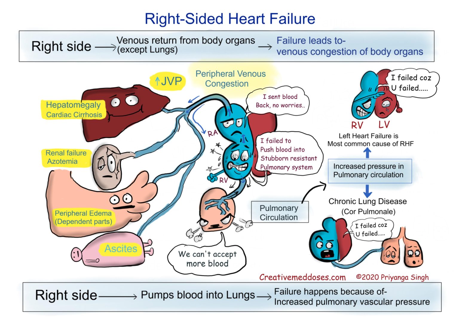 How Does Pulmonary Hypertension Cause Right Sided Heart Failure