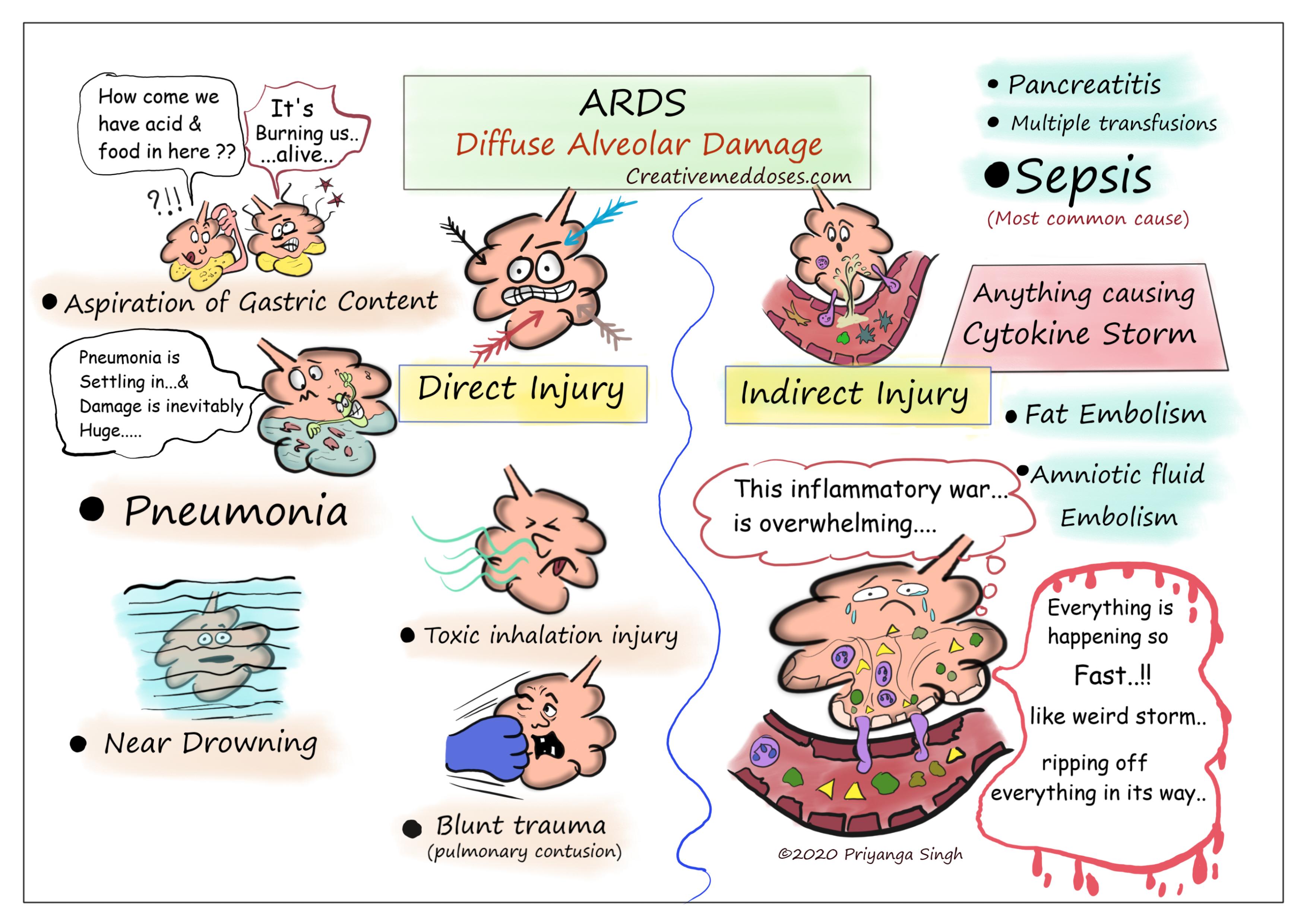 Acute Respiratory Distress Syndrome (Ards) - Creative Med Doses