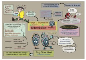 Sideroblastic Anemia: Anemia With Ring Sideroblasts - Creative Med Doses