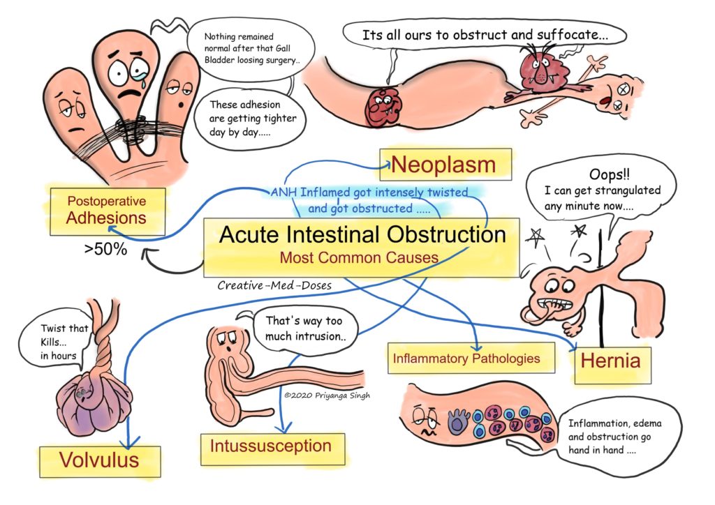 Acute intestinal obstruction: Pathophysiology - Creative Med Doses