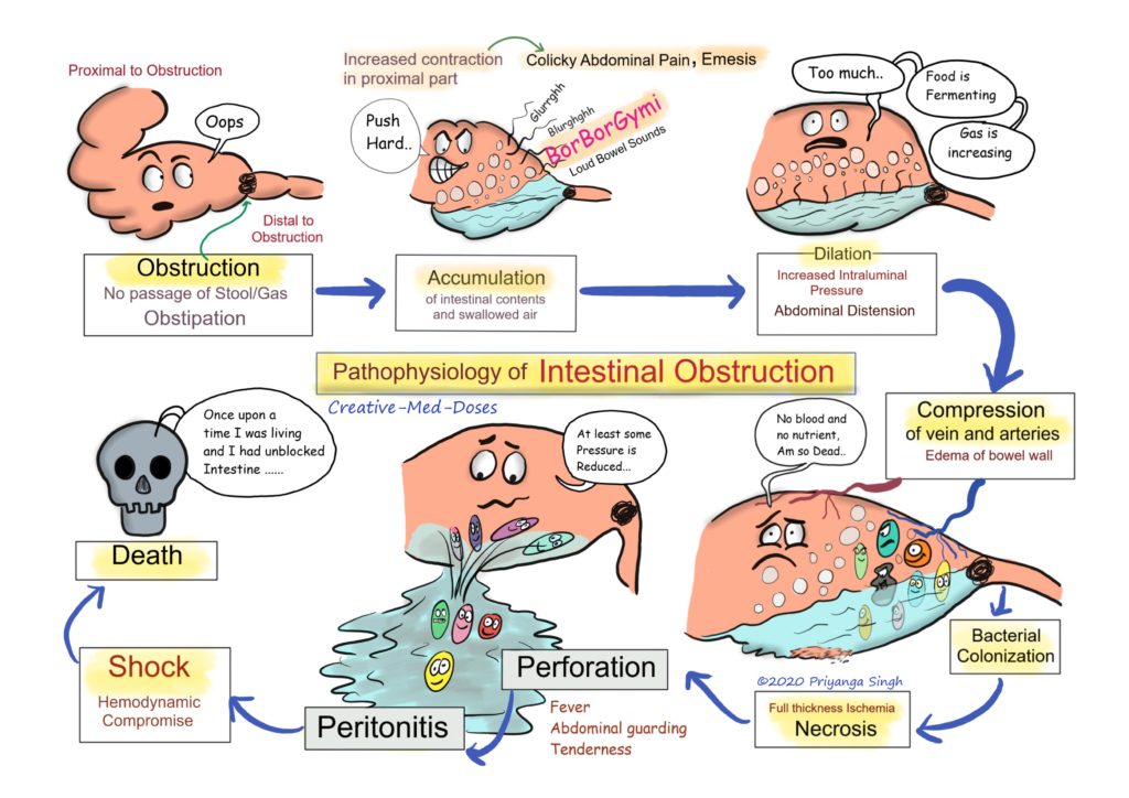 Acute intestinal obstruction: Pathophysiology - Creative Med Doses