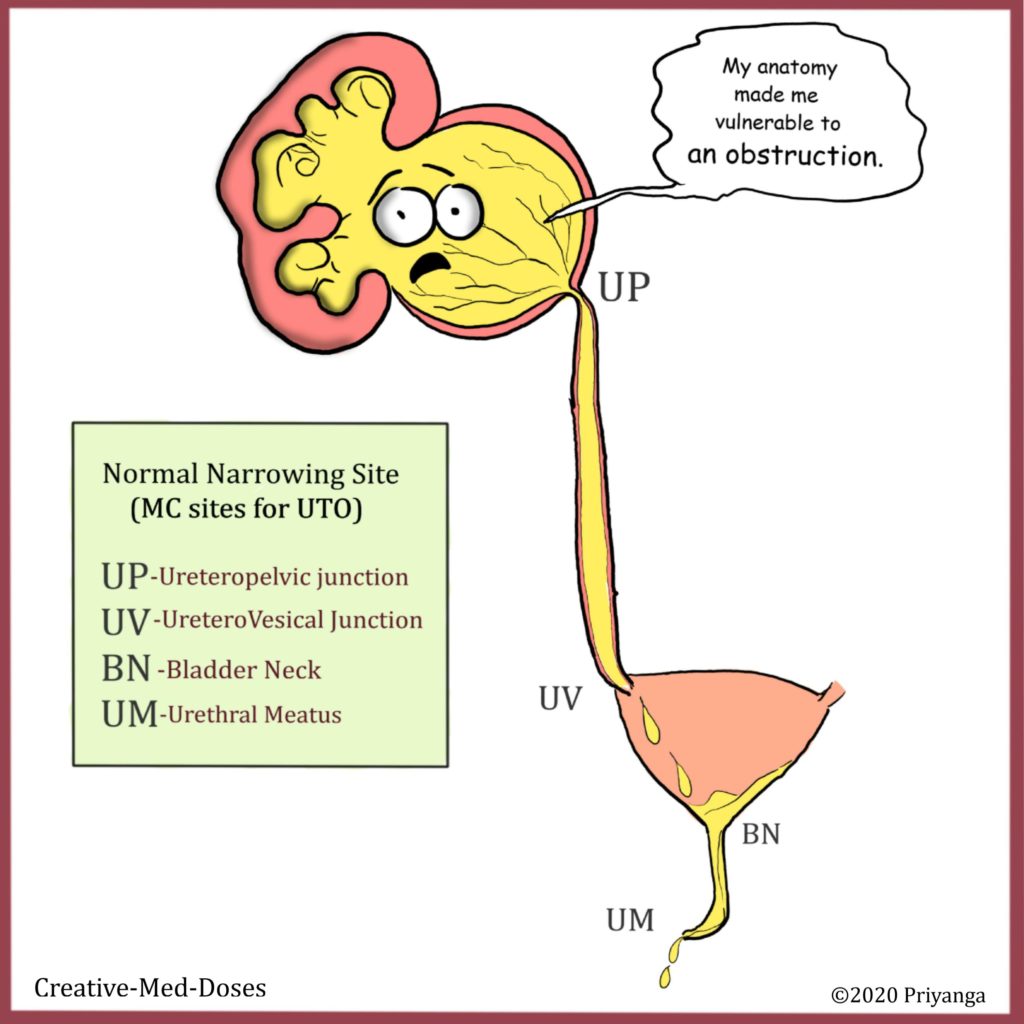 Urinary Tract Obstruction Most Common Sites - Creative Med Doses