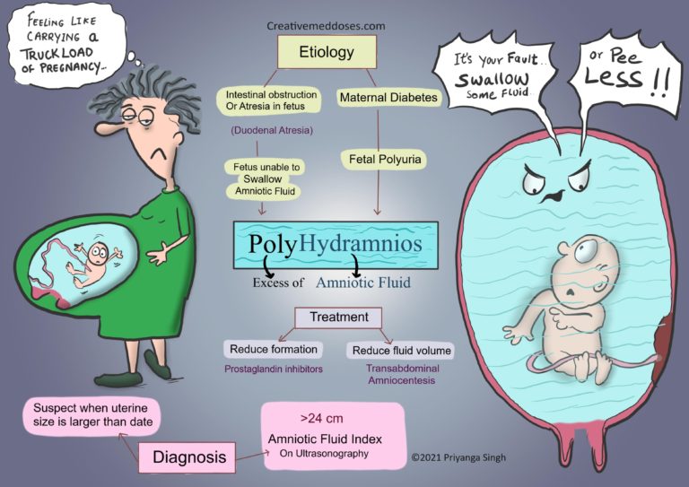 Polyhydramnios Excessive Amniotic Fluid Creative Med Doses polyhydramnios-excessive-amniotic-fluid-creative-med-doses