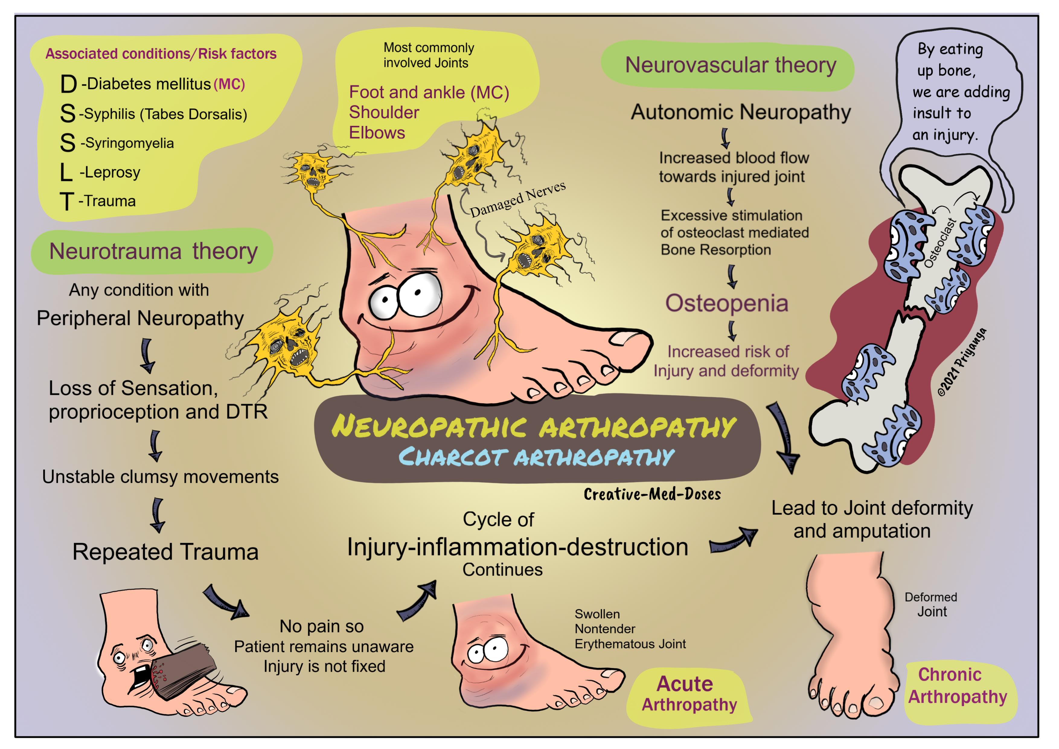 Neuropathic arthropathy (Charcot arthropathy): Clinical features and pathophysiology 