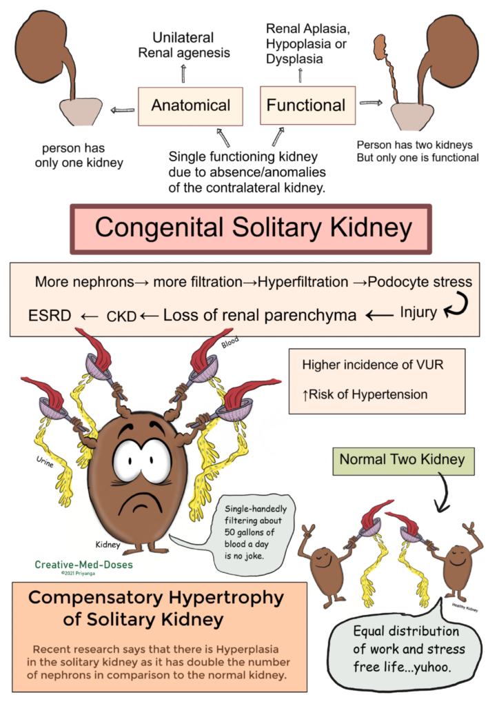 Congenital Solitary Kidney - Creative Med Doses