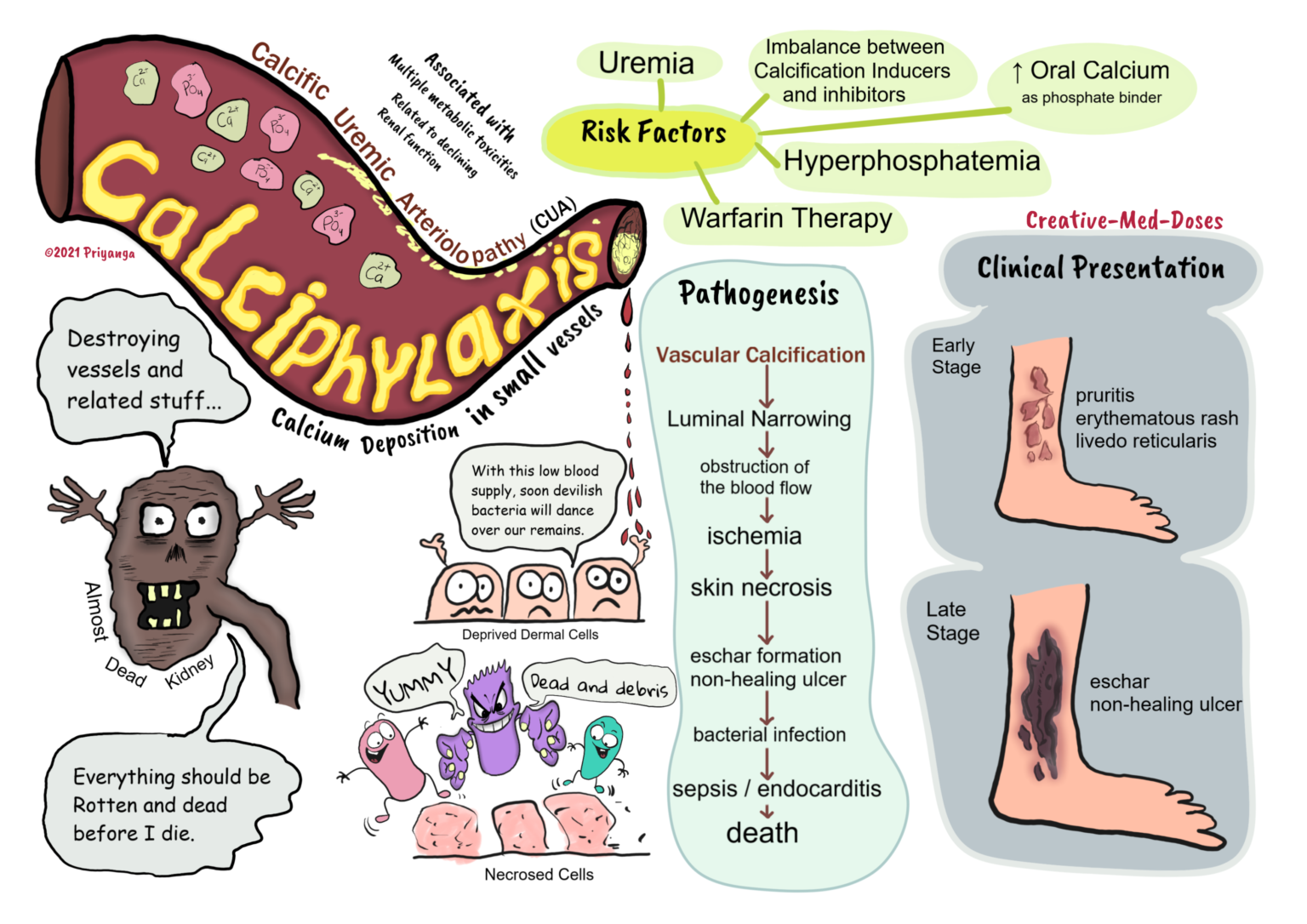 Calciphylaxis or calcific uremic arteriolopathy in CKD - Creative Med Doses