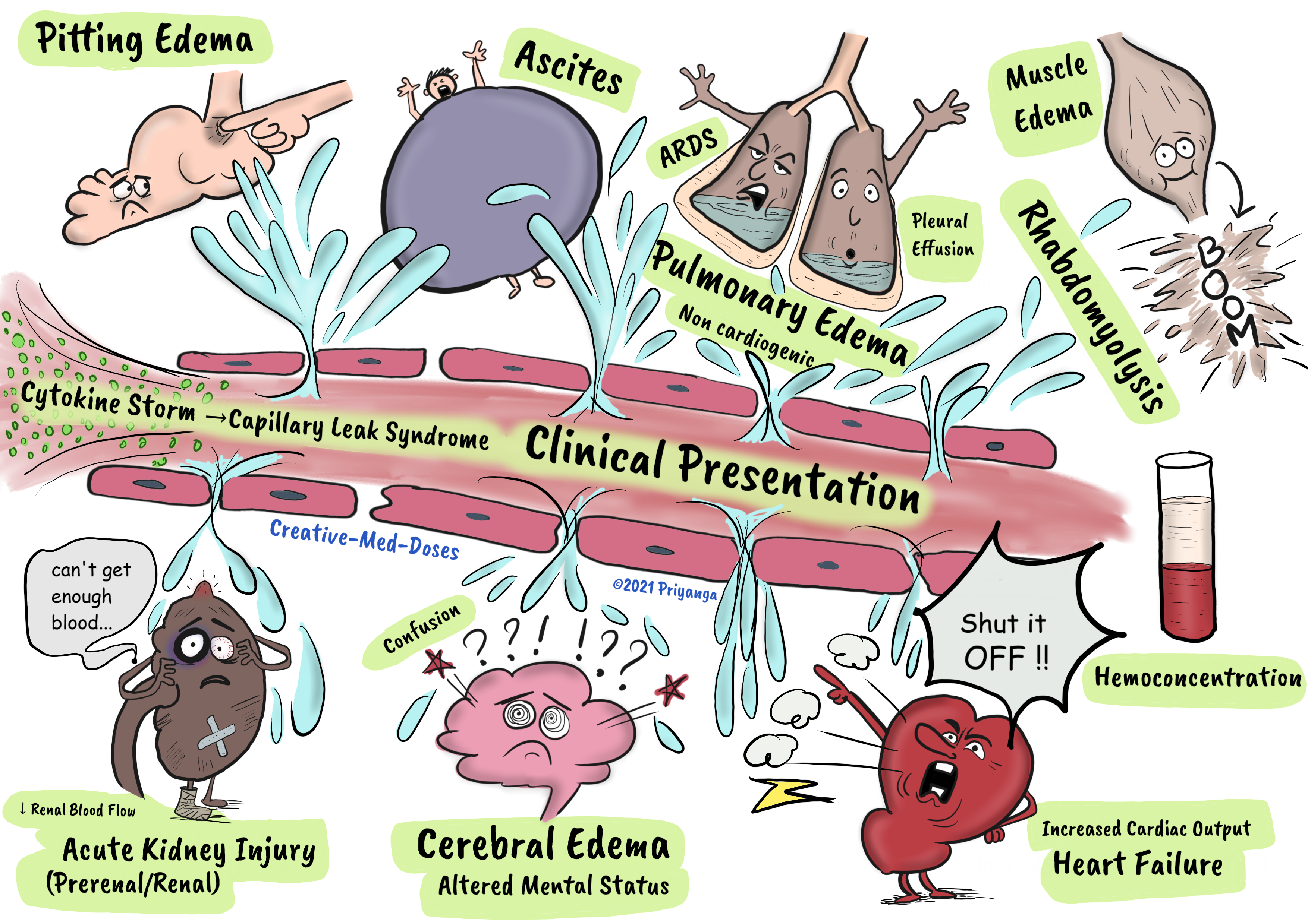Capillary Leak Syndrome: clinical presentation