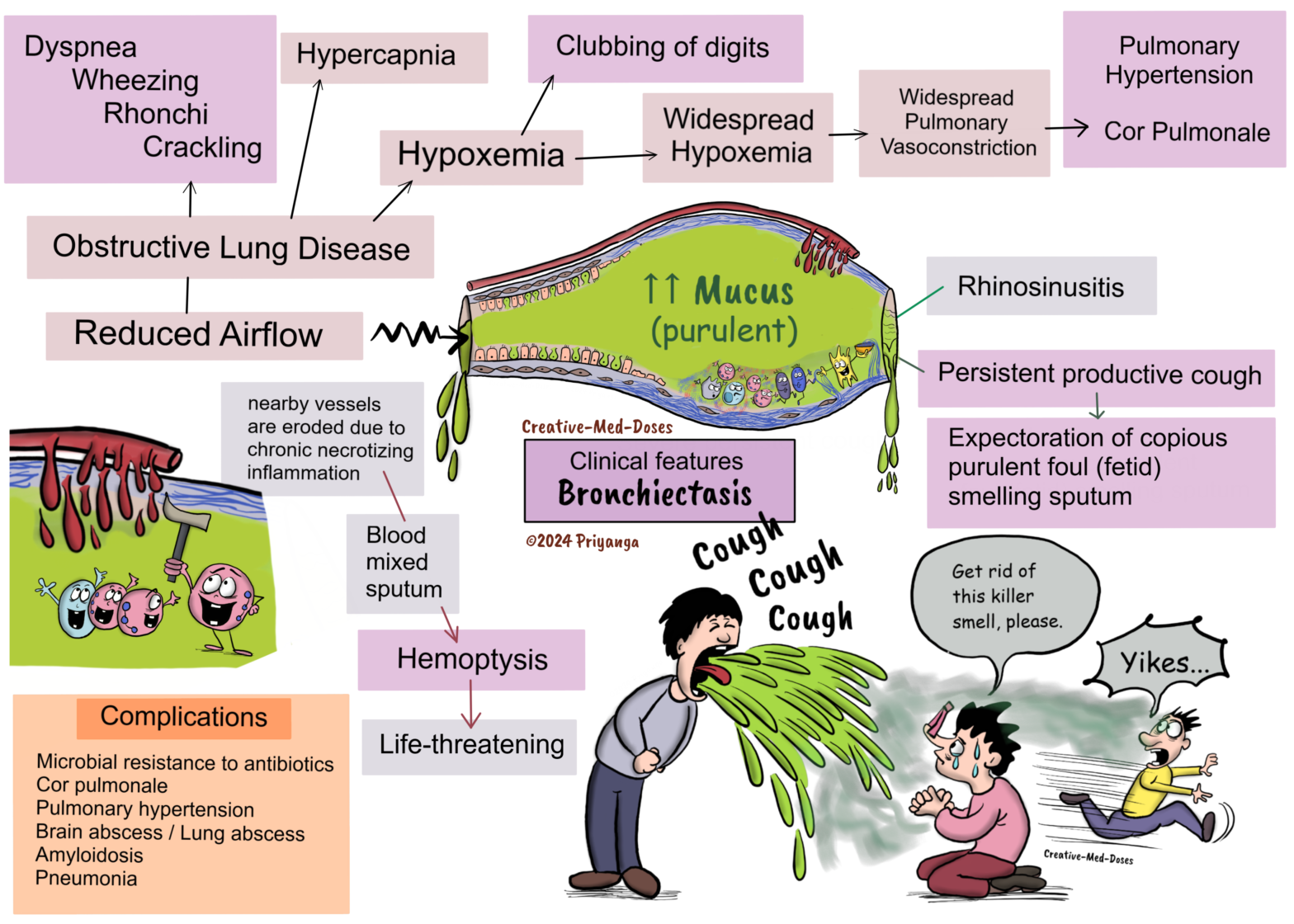 Bronchiectasis- clinical features