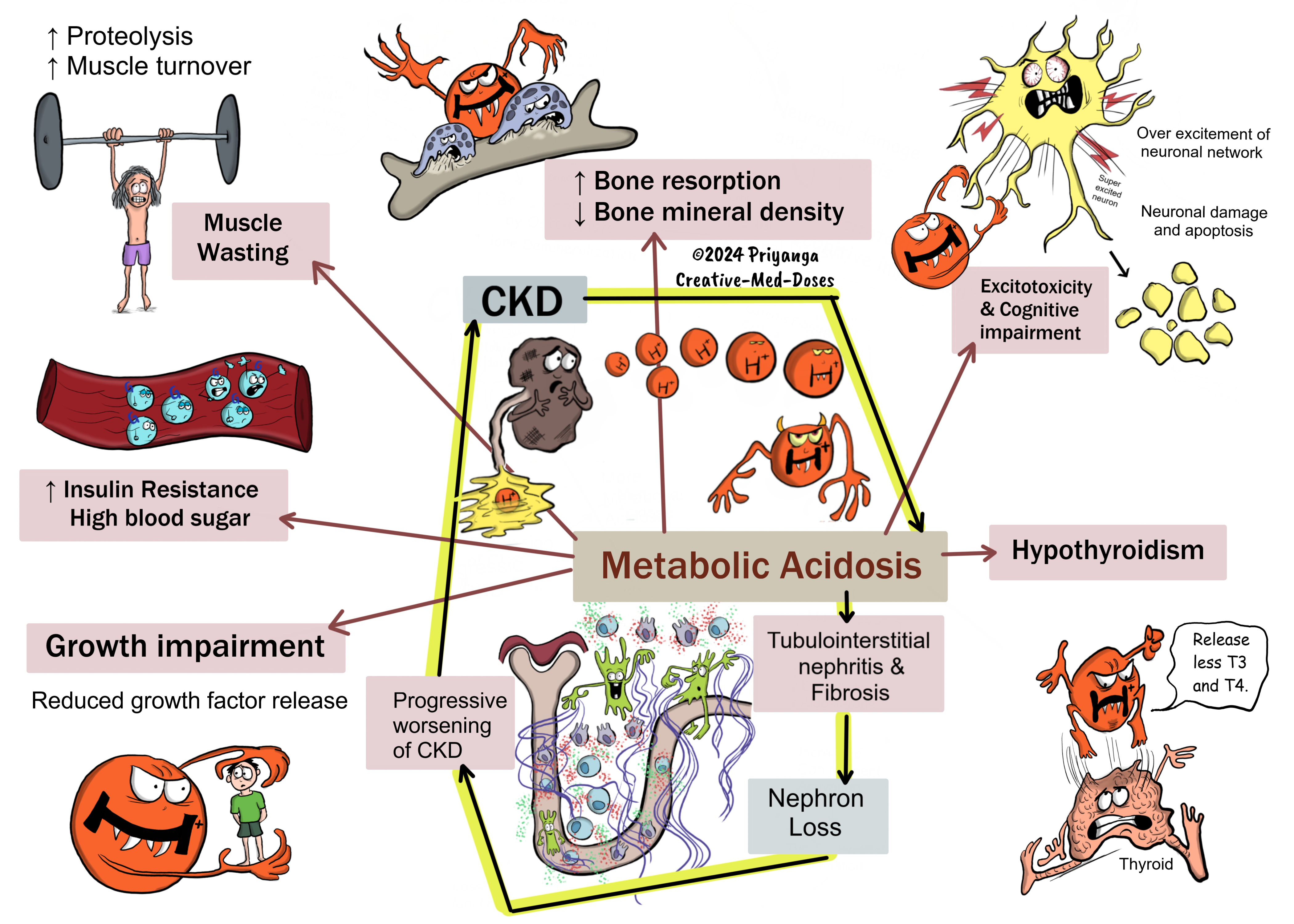 Metabolic acidosis in CKD