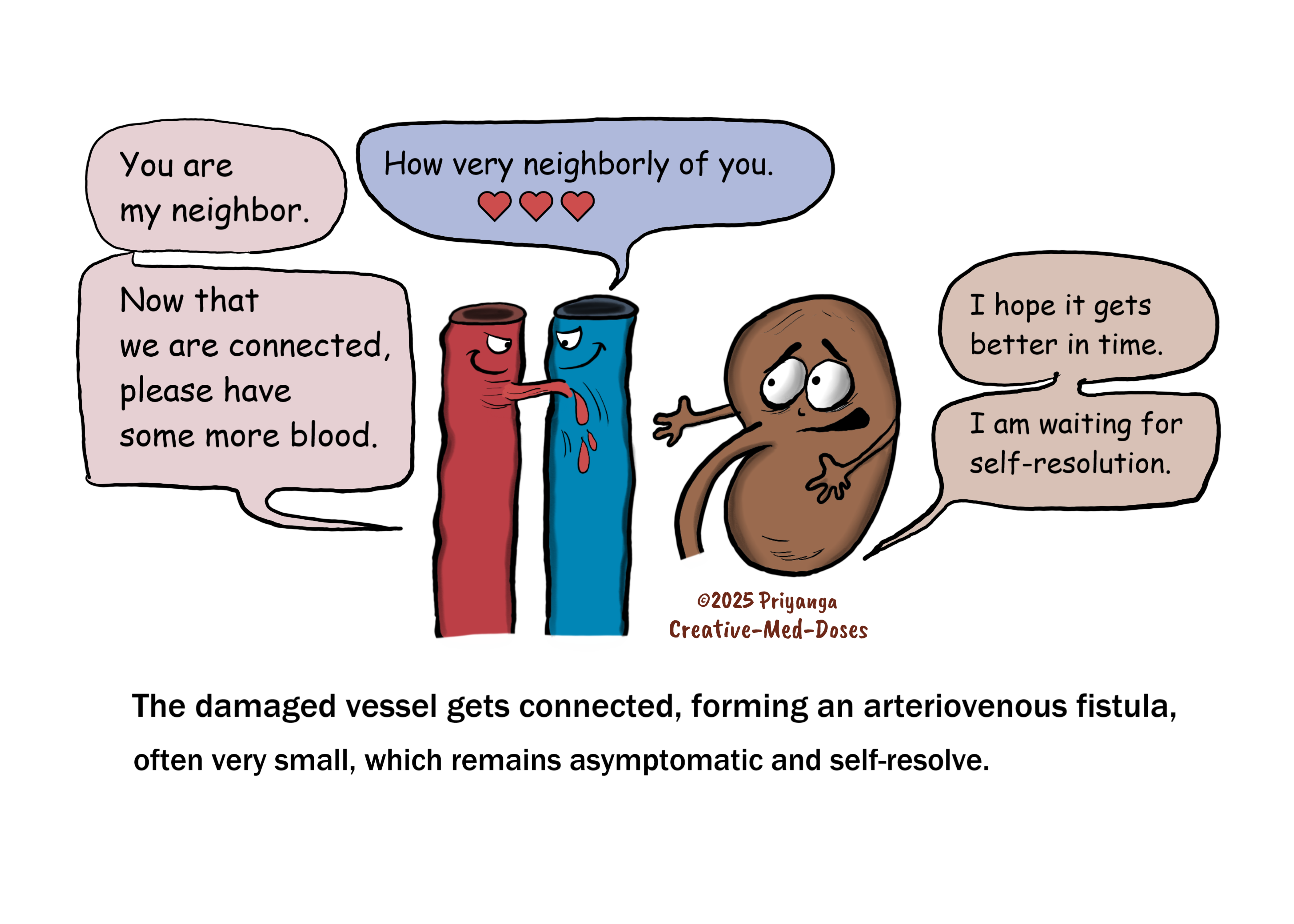 Arteriovenous fistula: the small fistula and blood flow